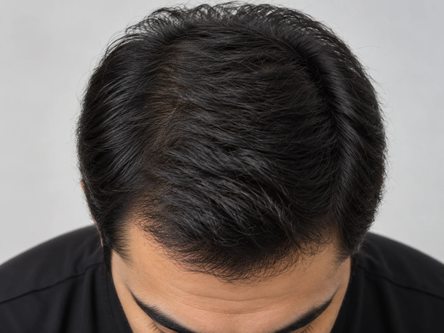 Hair After