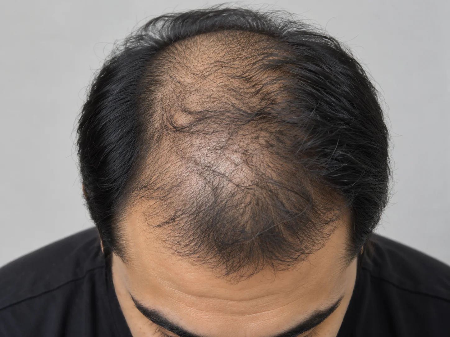 Hair brfore