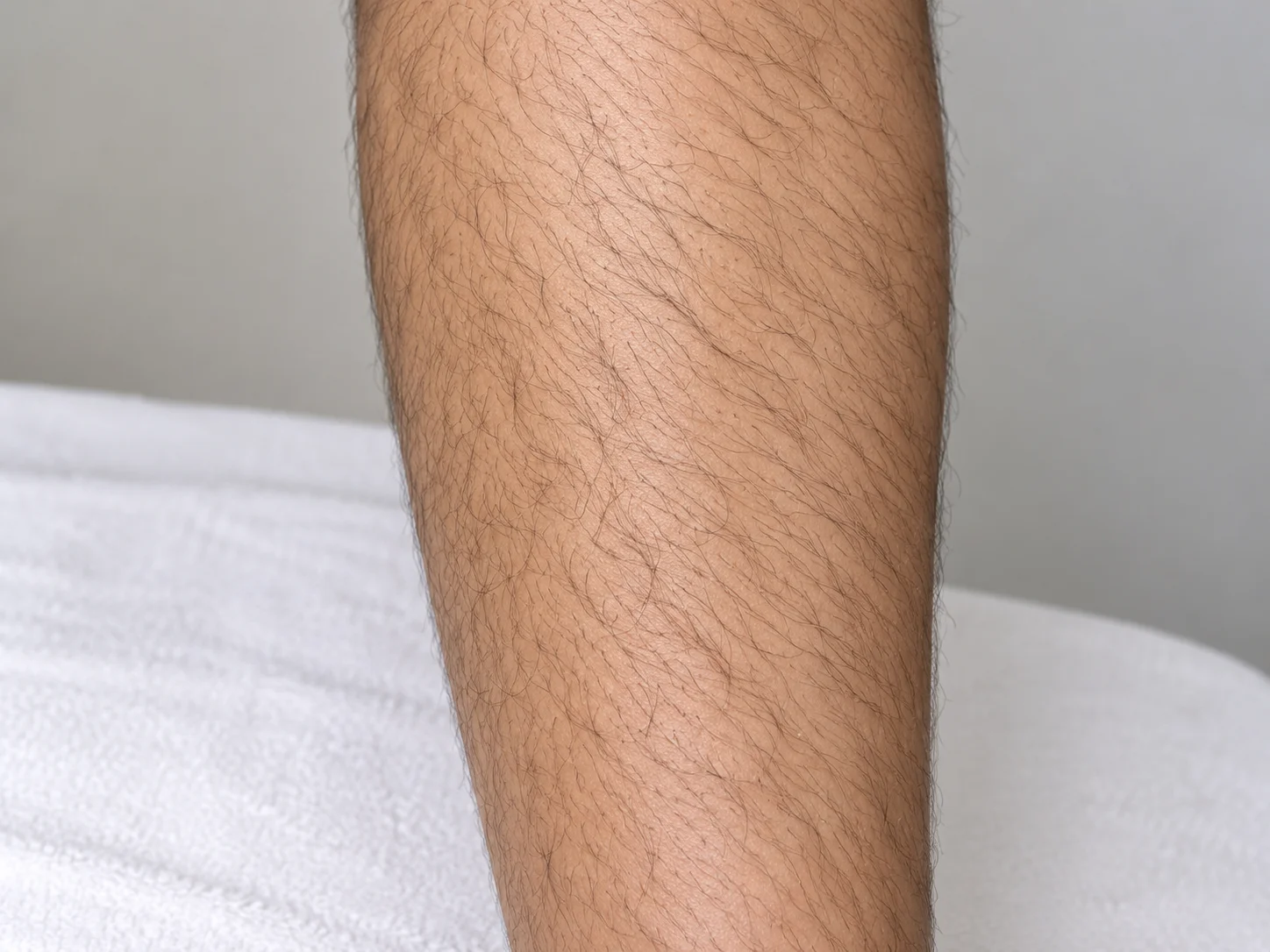 Laser Before